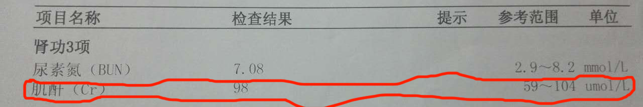 肌酐指数超出标准范围意味着肾可能出现问题：我的和朋友的情况对比